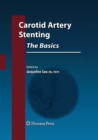 Carotid Artery Stenting: The Basics - Book
