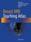 Breast MRI Teaching Atlas - Book