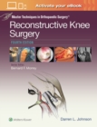Master Techniques in Orthopaedic Surgery: Reconstructive Knee Surgery - Book