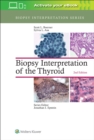 Biopsy Interpretation of the Thyroid - Book