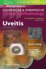 Uveitis - Book