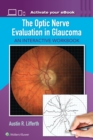 The Optic Nerve Evaluation in Glaucoma : An Interactive Workbook - Book