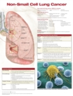 Non-Small Cell Lung Cancer - Book