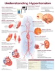 Understanding Hypertension Anatomical Chart - Book