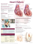 Heart Failure Anatomical Chart - Book