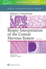 Biopsy Interpretation of the Central Nervous System - Book