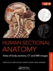 Human Sectional Anatomy : Atlas of Body Sections, CT and MRI Images, Fourth Edition - Book