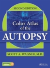 Color Atlas of the Autopsy - Book