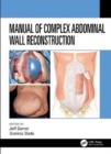 Manual of Complex Abdominal Wall Reconstruction - Book
