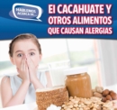 El cacahuate y otros alimentos que causan alergias (Peanut and Other Food Allergies) - eBook