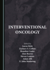 None Interventional Oncology - eBook