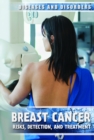 Breast Cancer : Risks, Detection, and Treatment - eBook