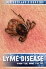 Lyme Disease : When Ticks Make You Sick - eBook
