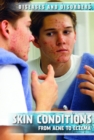 Skin Conditions : From Acne to Eczema - eBook