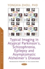 Typical Imaging in Atypical Parkinson's, Schizophrenia, Epilepsy and Asymptomatic Alzheimer's Disease - Book