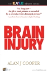 Brain Injury - eBook
