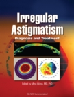 Irregular Astigmatism : Diagnosis and Treatment - Book