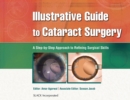Illustrative Guide to Cataract Surgery : A Step-by-Step Approach to Refining Surgical Skills - Book