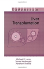 Liver Transplantation - Book