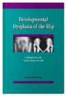 Developmental Dysplasia of the Hip - Book