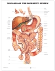 Diseases of the Digestive System Anatomical Chart - Book