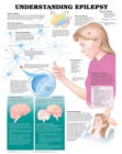 Understanding Epilepsy Anatomical Chart - Book