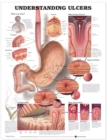 Understanding Ulcers Anatomical Chart - Book
