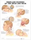 Whiplash Injuries of the Head and Neck Anatomical Chart - Book
