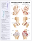 Understanding Arthritis Anatomical Chart - Book