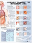Sexually Transmitted Infections Anatomical Chart - Book