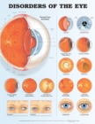Disorders of the Eye Anatomical Chart - Book
