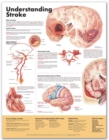 Understanding Stroke Anatomical Chart - Book