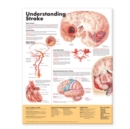 Understanding Stroke Anatomical Chart - Book