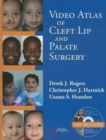 Video Atlas of Cleft Lip and  Palate Surgery - Book