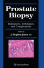 Prostate Biopsy : Indications, Techniques, and Complications - eBook