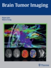 Brain Tumor Imaging - Book