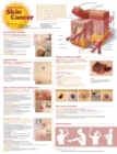 Understanding Skin Cancer Anatomical Chart - Book