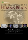Imaging Anatomy of the Human Brain : A Comprehensive Atlas Including Adjacent Structures - eBook