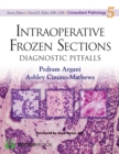 Intraoperative Frozen Sections : Diagnostic Pitfalls - eBook