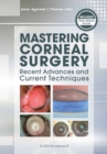 Mastering Corneal Surgery : Recent Advances and Current Techniques - Book