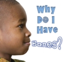 Why Do I Have Bones? - eBook