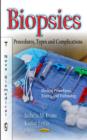 Biopsies : Procedures, Types & Complications - Book