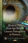Modern Data About Age-Related Cataract Pathogenesis in Humans - Book
