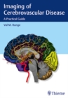 Imaging of Cerebrovascular Disease : A Practical Guide - Book
