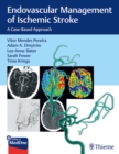Endovascular Management of Ischemic Stroke : A Case-Based Approach - Book