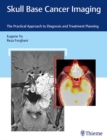 Skull Base Cancer Imaging : The Practical Approach to Diagnosis and Treatment Planning - Book
