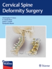 Cervical Spine Deformity Surgery - Book