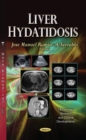 Liver Hydatidosis - Book