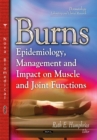 Burns : Epidemiology, Management & Impact on Muscle & Joint Functions - Book
