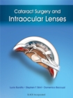 Cataract Surgery and Intraocular Lenses - eBook